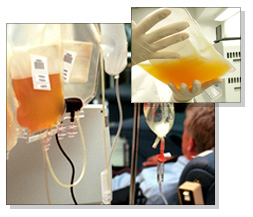 plasma bag
