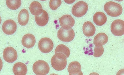blood